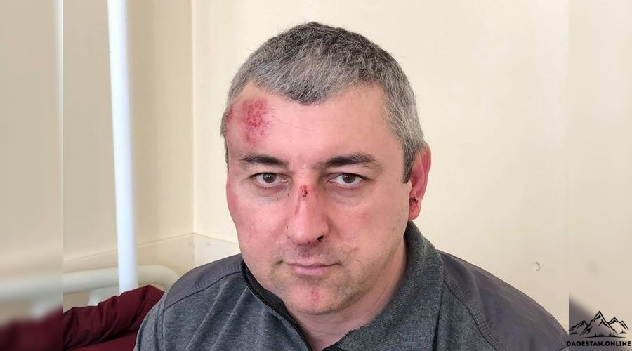 После нападения на главу "Мемориала" в Дагестане возбудили дело   После нападения на главу "Мемориала" в Дагестане возбудили дело   фото